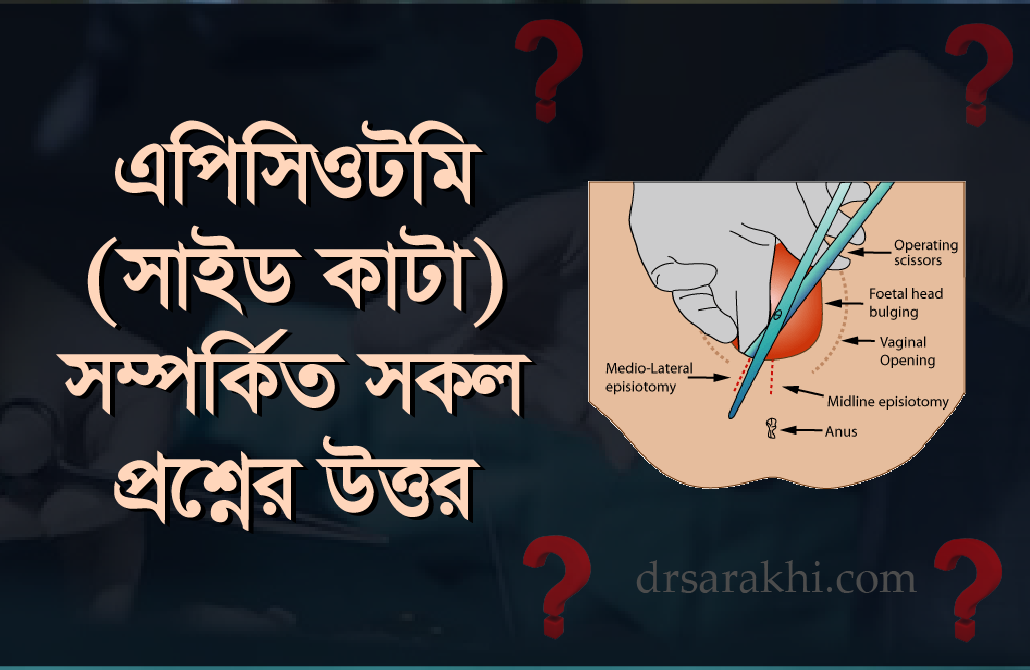 নরমাল ডেলিভারিতে সাইড কাটা (এপিসিওটমি) সম্পর্কে বিস্তারিত জানুন